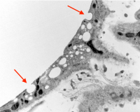 A fat cell preparing two exosomes (AdExos) filled with lipid